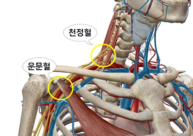 목과 어깨 부위의 신경, 혈관, 근육, 뼈를 보여주는 3D 해부학 그림으로, 천정혈과 운문혈이 노란색 원으로 표시되어 있습니다 — 서울 바로한의원 초음파 약침·도침