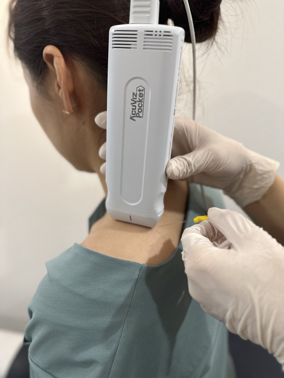 환자의 어깨 부위에 초음파 기기를 대고 침 치료를 준비하는 모습 — 초음파 정밀 진단 | 서울 바로한의원 초음파 약침·도침·침도