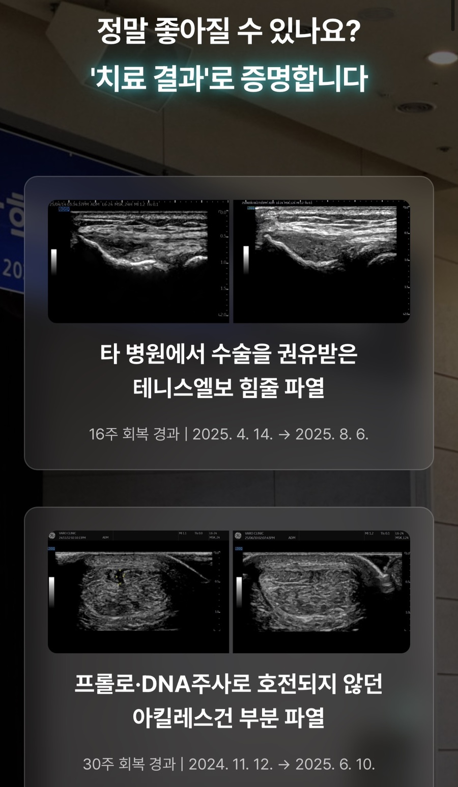 테니스엘보 힘줄 파열과 아킬레스건 부분 파열의 치료 전후를 보여주는 두 쌍의 초음파 이미지와 회복 경과 정보 — 초음파 정밀 진단 | 서울 바로한의원 초음파 약침·도침·침도