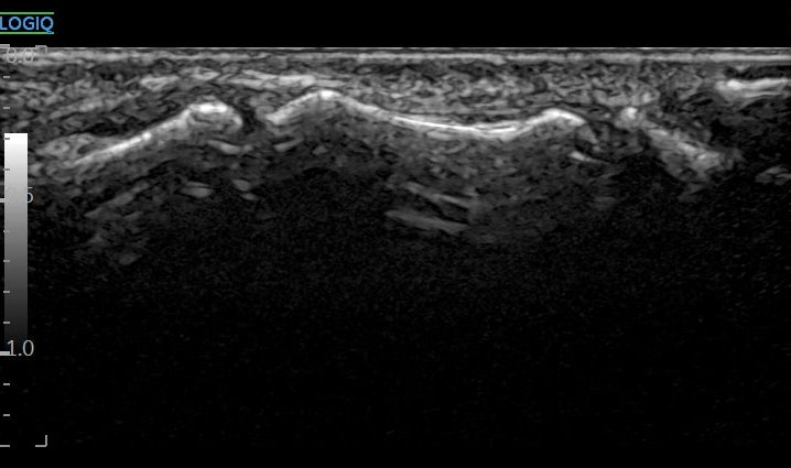 발가락 부위의 내부 구조를 보여주는 초음파 영상 — 초음파 정밀 진단 | 서울 바로한의원 초음파 약침·도침·침도