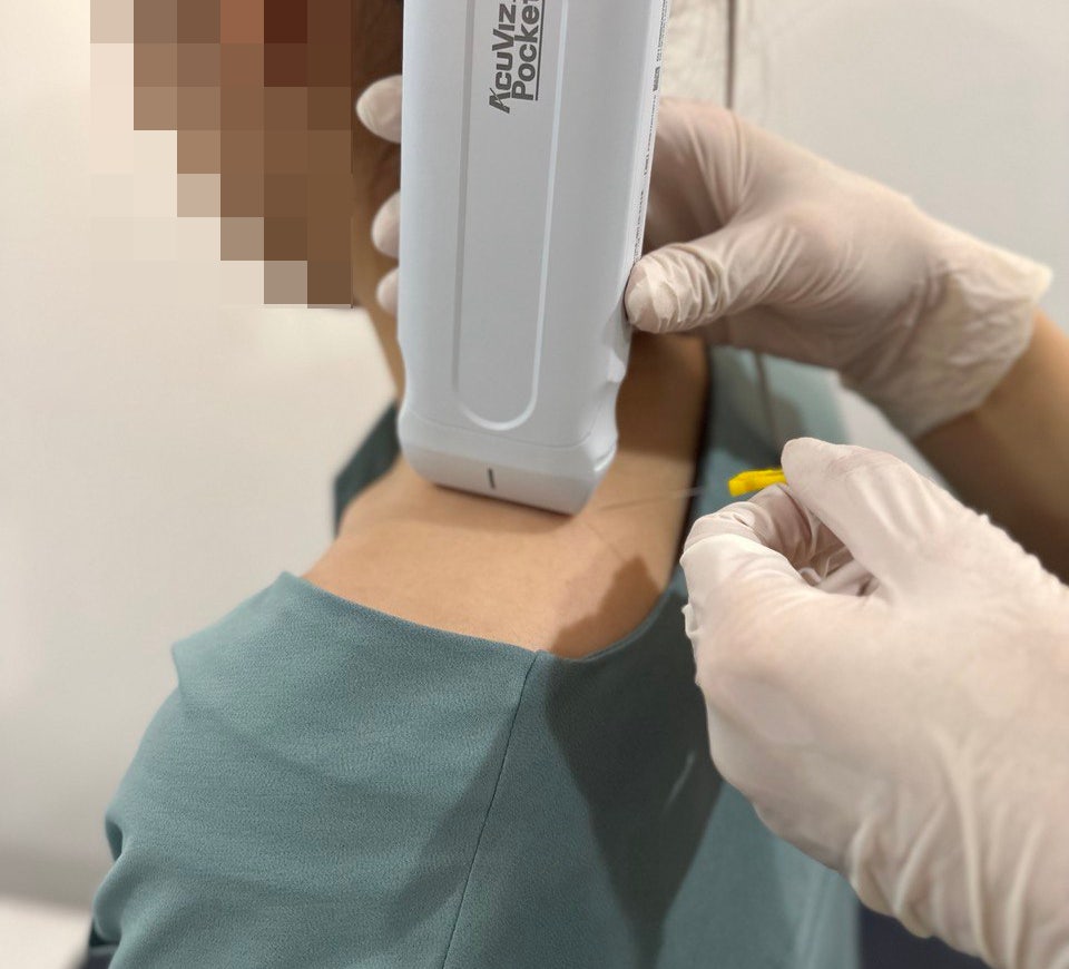 환자의 목과 어깨 부위에 초음파 기기를 대고 침 시술을 준비하는 모습 — 초음파 유도하 약침 시술 | 서울 바로한의원