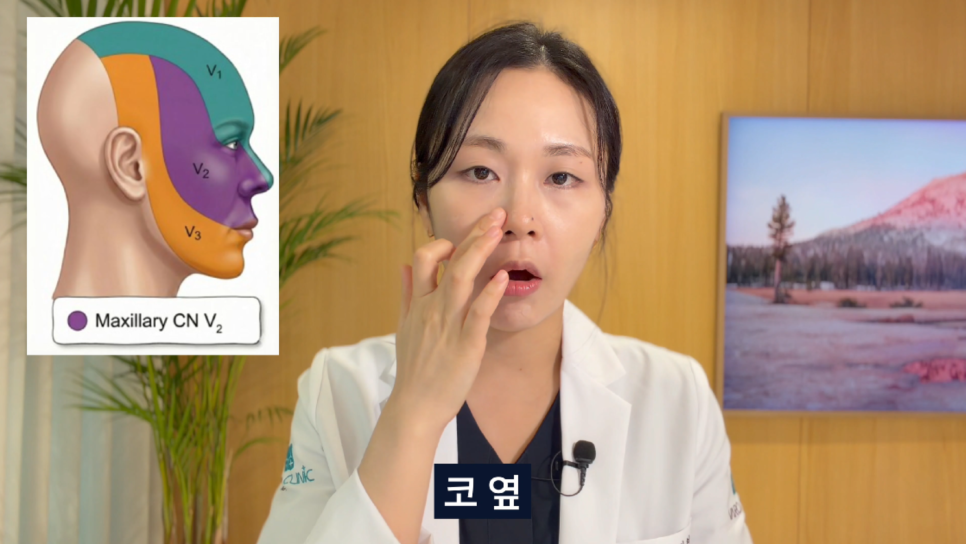 얼굴의 삼차신경 분포를 나타내는 그림과 코 옆을 가리키는 여성의 모습 — 서울 바로한의원 초음파 약침·도침