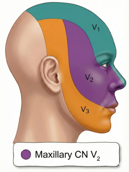 사람 얼굴 측면에 삼차신경의 세 가지 분지(V1, V2, V3) 분포 영역을 색깔로 표시한 그림 — 서울 바로한의원 초음파 약침·도침