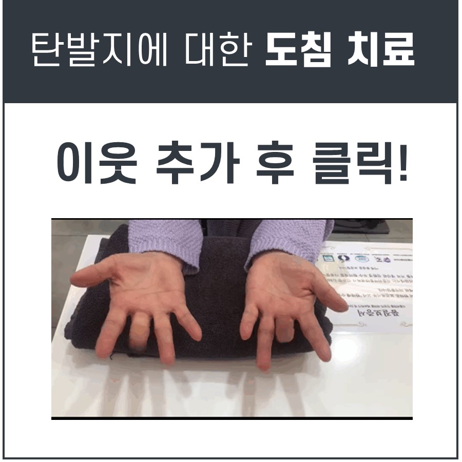 두 손바닥을 위로 향하게 하여 손가락을 구부린 모습으로, 왼쪽 손의 한 손가락이 완전히 펴지지 않은 상태를 보여준다 — 서울 바로한의원 초음파 약침·도침
