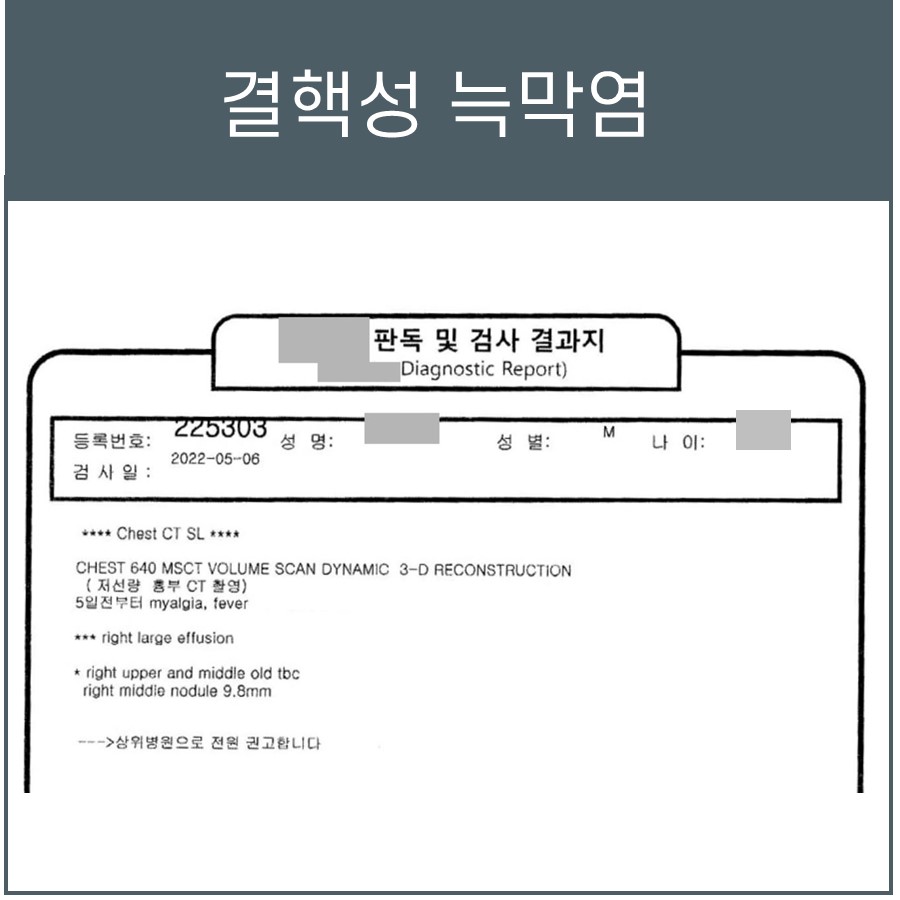 결핵성 늑막염 진단이 적힌 흉부 CT 판독 결과지 — 서울 바로한의원 초음파 약침·도침