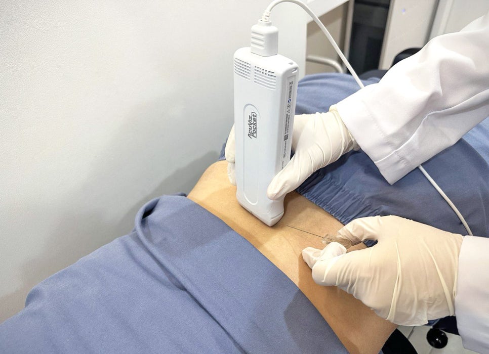 의료진이 환자의 등에 초음파 기기를 대고 도침을 시술하는 모습 — 초음파 유도하 약침 시술 | 서울 바로한의원