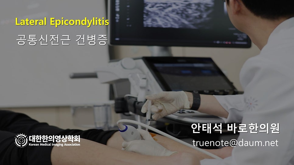 의사가 환자의 팔에 초음파 탐촉자를 대고 초음파 화면을 보며 주사기로 약침 시술을 준비하는 모습 — 초음파 유도하 약침 시술 | 서울 바로한의원