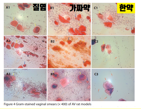 질염, 가짜약, 한약 투여 쥐 모델의 그람 염색 질 도말 표본 현미경 사진 — 서울 바로한의원 초음파 약침·도침
