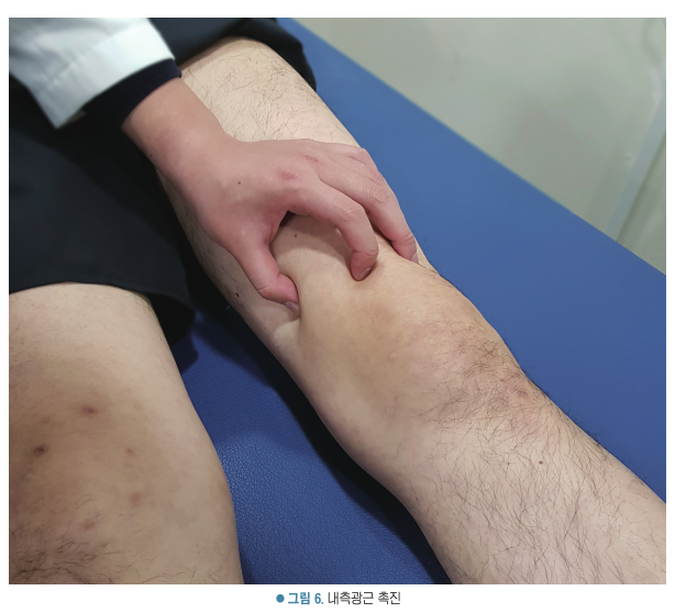 한 손이 무릎 위 허벅지 안쪽 근육을 촉진하는 모습 — 서울 바로한의원 초음파 약침·도침