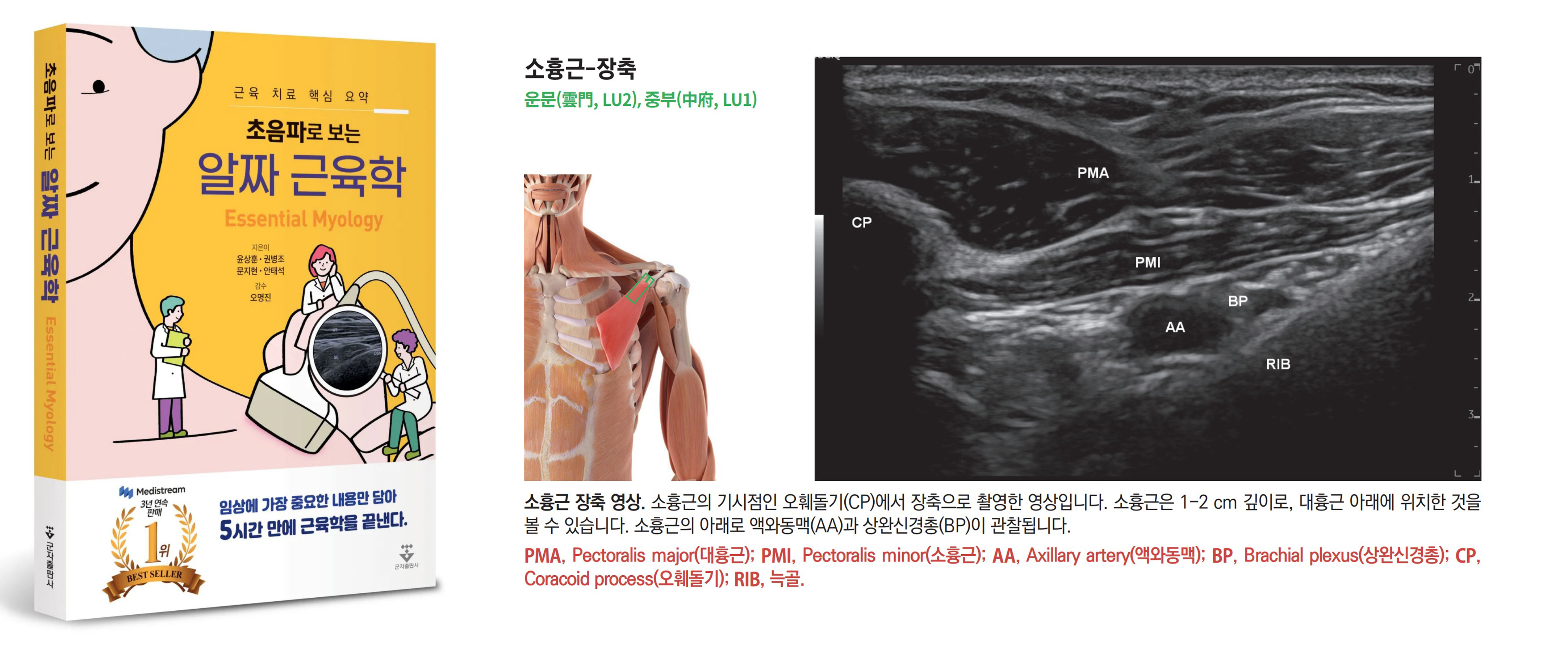 근육 초음파 저서