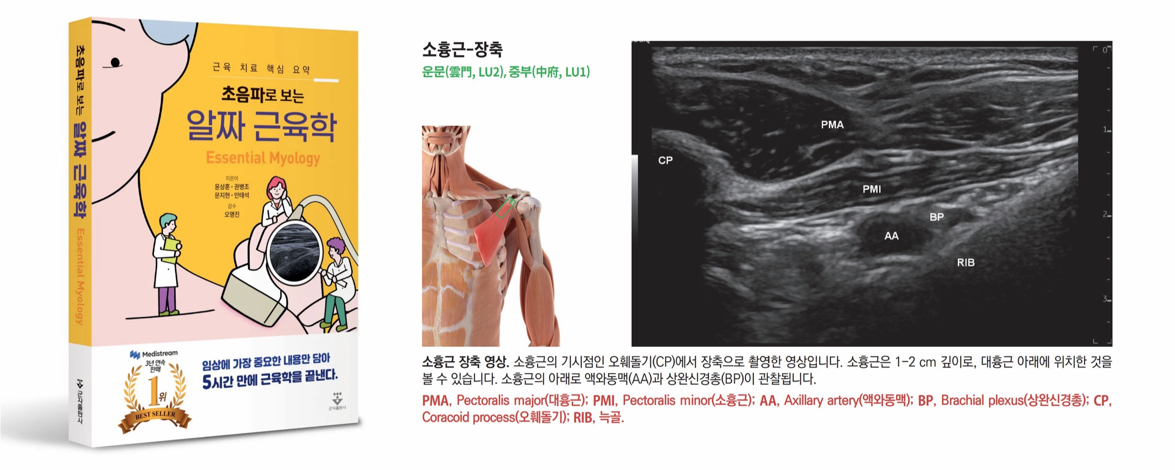 『초음파로 보는 알짜 근육학』 저서 — 근육 초음파·초음파 침도 임상 해설