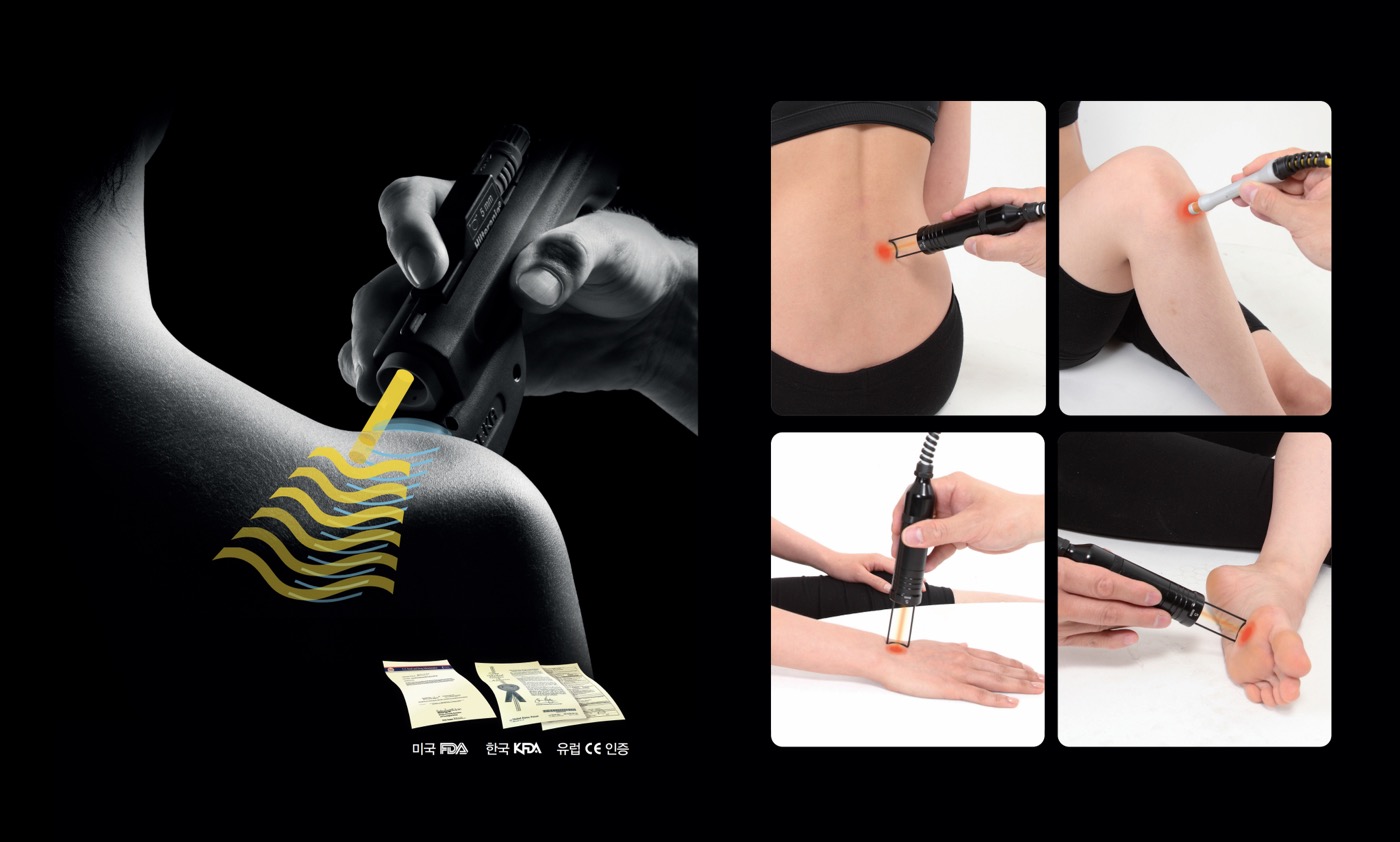 힐트 고강도 레이저 적응증 — 힘줄·인대·관절·신경 통증 치료